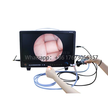 SY-PS050 Nov Prihod 3CCD HD Video Sistem Za Laparoscopy Hysteroscopy Artroskopijo Vlaken